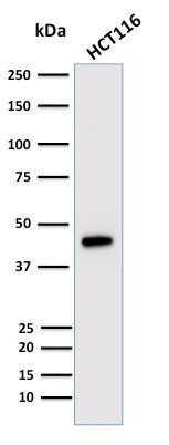 Cytokeratin 18 Antibody (KRT18/835) - IHC-Prediluted Western Blot: Cytokeratin 18 Antibody (KRT18/835) - IHC-Prediluted [NBP2-48065] -