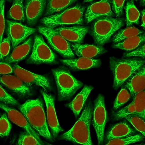 Cytokeratin 18 Antibody (KRT18/836) - IHC-Prediluted Immunocytochemistry/ Immunofluorescence: Cytokeratin 18 Antibody (KRT18/836) - IHC-Prediluted [NBP2-48066] -