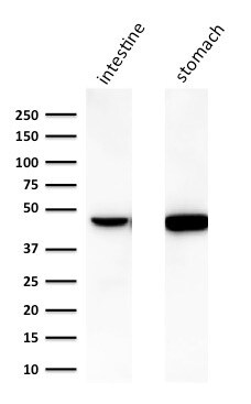 Cytokeratin 18 Antibody (C-04 (same as Ks18.04)) - IHC-Prediluted Western Blot: Cytokeratin 18 Antibody (C-04 (same as Ks18.04)) - IHC-Prediluted [NBP2-48075] -
