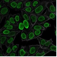 H1F0 Antibody (AE-4) - IHC-Prediluted Immunocytochemistry/ Immunofluorescence: H1F0 Antibody (AE-4) - IHC-Prediluted [NBP2-48077] -
