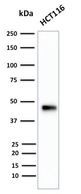 Cytokeratin 18 Antibody (B23.1) - IHC-Prediluted Western Blot: Cytokeratin 18 Antibody (B23.1) - IHC-Prediluted [NBP2-48085] -