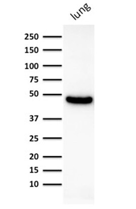Cytokeratin 19 Antibody (KRT19/800) - IHC-Prediluted Western Blot: Cytokeratin 19 Antibody (KRT19/800) - IHC-Prediluted [NBP2-48095] -