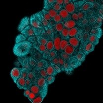 Cytokeratin 19 Antibody (KRT19/800) - IHC-Prediluted Immunocytochemistry/ Immunofluorescence: Cytokeratin 19 Antibody (KRT19/800) - IHC-Prediluted [NBP2-48095] -