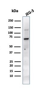 Alkaline Phosphatase/ALPP Antibody (PL8-F6) - IHC-Prediluted Western Blot: Alkaline Phosphatase/ALPP Antibody (PL8-F6) - IHC-Prediluted [NBP2-48110] -