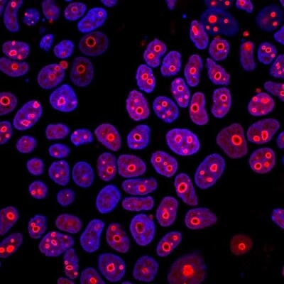 Cyclin B1 Antibody (CCNB1/1098) - IHC-Prediluted Immunocytochemistry/ Immunofluorescence: Cyclin B1 Antibody (CCNB1/1098) - IHC-Prediluted [NBP2-48117] -