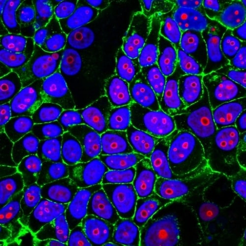 Cyclin B1 Antibody (CCNB1/1098) - IHC-Prediluted Immunocytochemistry/ Immunofluorescence: Cyclin B1 Antibody (CCNB1/1098) - IHC-Prediluted [NBP2-48117] -