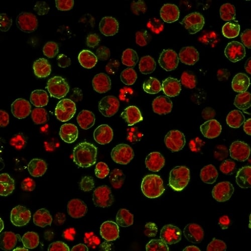 HLA DRB1 Antibody (SPM423) - IHC-Prediluted Immunocytochemistry/ Immunofluorescence: HLA DRB1 Antibody (SPM423) - IHC-Prediluted [NBP2-48123] -