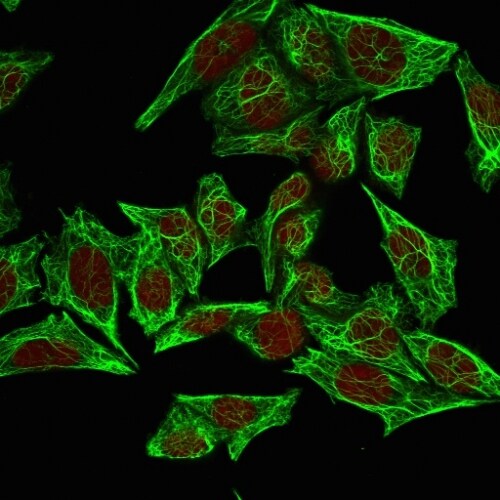 Cytokeratin 7 Antibody (SPM270) - IHC-Prediluted Immunocytochemistry/ Immunofluorescence: Cytokeratin 7 Antibody (SPM270) - IHC-Prediluted [NBP2-48124] -