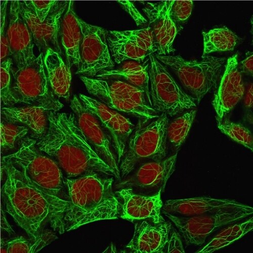 Cytokeratin 7 Antibody (K72.7) - IHC-Prediluted Immunocytochemistry/ Immunofluorescence: Cytokeratin 7 Antibody (K72.7) - IHC-Prediluted [NBP2-48125] -