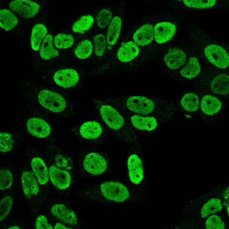 Cyclin B1 Antibody (SPM619) - IHC-Prediluted Immunocytochemistry/ Immunofluorescence: Cyclin B1 Antibody (SPM619) - IHC-Prediluted [NBP2-48126] -