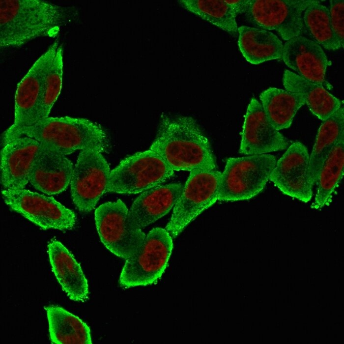 alpha-Smooth Muscle Actin Antibody (ACTA2/791) - IHC-Prediluted Immunocytochemistry/ Immunofluorescence: alpha-Smooth Muscle Actin Antibody (ACTA2/791) - IHC-Prediluted [NBP2-48132] -