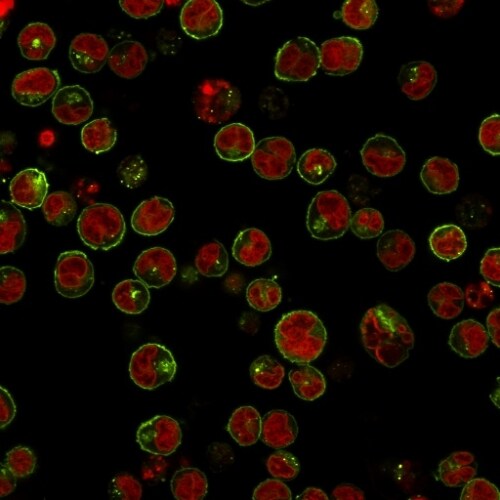 HLA DRB1 Antibody (HLA-DRB/1067) - IHC-Prediluted Immunocytochemistry/ Immunofluorescence: HLA DRB1 Antibody (HLA-DRB/1067) - IHC-Prediluted [NBP2-48135] -