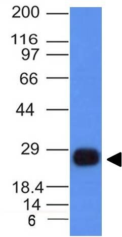 HLA DRB1 Antibody (HLA-DRB/1067) - IHC-Prediluted Western Blot: HLA DRB1 Antibody (HLA-DRB/1067) - IHC-Prediluted [NBP2-48135] -