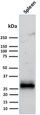 HLA DRB1 Antibody (LN-3 + HLA-DRB/1067) - IHC-Prediluted Western Blot: HLA DRB1 Antibody (LN-3 + HLA-DRB/1067) - IHC-Prediluted [NBP2-48136] -