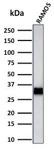 HLA DRB1 Antibody (LN-3 + HLA-DRB/1067) - IHC-Prediluted Western Blot: HLA DRB1 Antibody (LN-3 + HLA-DRB/1067) - IHC-Prediluted [NBP2-48136] -