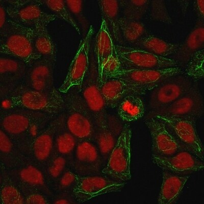 Cytokeratin 7 Antibody (KRT7/903) - IHC-Prediluted Immunocytochemistry/ Immunofluorescence: Cytokeratin 7 Antibody (KRT7/903) - IHC-Prediluted [NBP2-48139] -