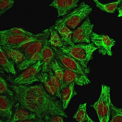 Cytokeratin 7 Antibody (KRT7/760) - IHC-Prediluted Immunocytochemistry/ Immunofluorescence: Cytokeratin 7 Antibody (KRT7/760) - IHC-Prediluted [NBP2-48140] -