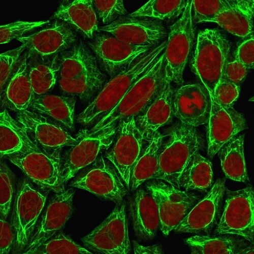 Cytokeratin 7 Antibody (KRT7/760 + KRT7/903) - IHC-Prediluted Immunocytochemistry/ Immunofluorescence: Cytokeratin 7 Antibody (KRT7/760 + KRT7/903) - IHC-Prediluted [NBP2-48143] -