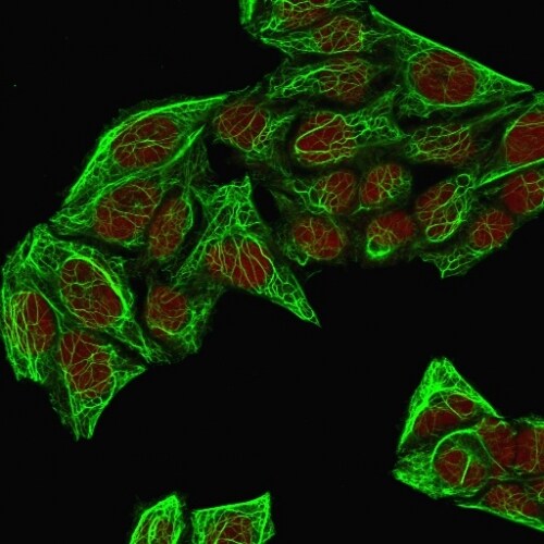Cytokeratin 7 Antibody (KRT7/760 + OV-TL12/30) - IHC-Prediluted Immunocytochemistry/ Immunofluorescence: Cytokeratin 7 Antibody (KRT7/760 + OV-TL12/30) - IHC-Prediluted [NBP2-48144] -