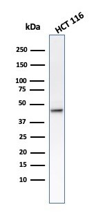 Cytokeratin 8 Antibody (B22.1) - IHC-Prediluted Western Blot: Cytokeratin 8 Antibody (B22.1) - IHC-Prediluted [NBP2-48146] -