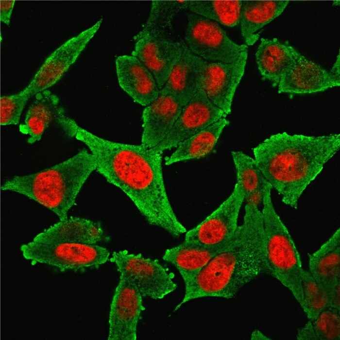 alpha-Smooth Muscle Actin Antibody (1A4 + ACTA2/791) - IHC-Prediluted Immunocytochemistry/ Immunofluorescence: alpha-Smooth Muscle Actin Antibody (1A4 + ACTA2/791) - IHC-Prediluted [NBP2-48157] -