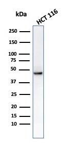 Cytokeratin 8 Antibody (C-43) - IHC-Prediluted Western Blot: Cytokeratin 8 Antibody (C-43) - IHC-Prediluted [NBP2-48169] -
