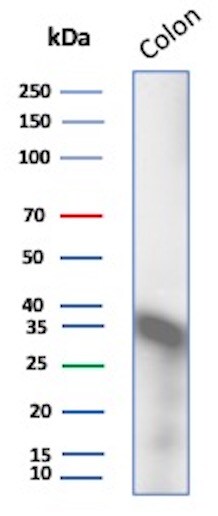 Calponin 1 Antibody (CALP) - IHC-Prediluted Western Blot: Calponin 1 Antibody (CALP) - IHC-Prediluted [NBP2-48184] -