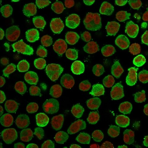 Calponin 1 Antibody (CALP) - IHC-Prediluted Immunocytochemistry/ Immunofluorescence: Calponin 1 Antibody (CALP) - IHC-Prediluted [NBP2-48184] -