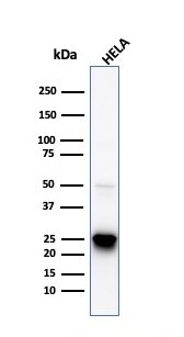 HSP27 Antibody (HSPB1/774) - IHC-Prediluted Western Blot: HSP27 Antibody (HSPB1/774) - IHC-Prediluted [NBP2-48186] -