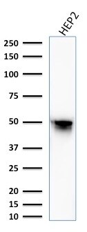 Vimentin Antibody (VM1170) - IHC-Prediluted Western Blot: Vimentin Antibody (VM1170) - IHC-Prediluted [NBP2-48191] -