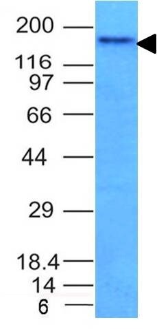 NCAM-1/CD56 Antibody (NCAM1/795) - IHC-Prediluted Western Blot: NCAM-1/CD56 Antibody (NCAM1/795) - IHC-Prediluted [NBP2-48193] -