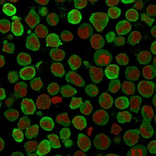 Calponin 1 Antibody (SPM169) - IHC-Prediluted Immunocytochemistry/ Immunofluorescence: Calponin 1 Antibody (SPM169) - IHC-Prediluted [NBP2-48204] -