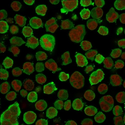 Calponin 1 Antibody (CNN1/832) - IHC-Prediluted Immunocytochemistry/ Immunofluorescence: Calponin 1 Antibody (CNN1/832) - IHC-Prediluted [NBP2-48205] -