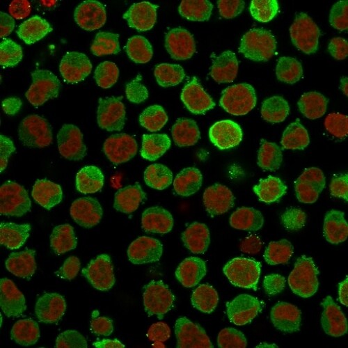 Calponin 1 Antibody (CNN1/832 + CALP) - IHC-Prediluted Immunocytochemistry/ Immunofluorescence: Calponin 1 Antibody (CNN1/832 + CALP) - IHC-Prediluted [NBP2-48206] -