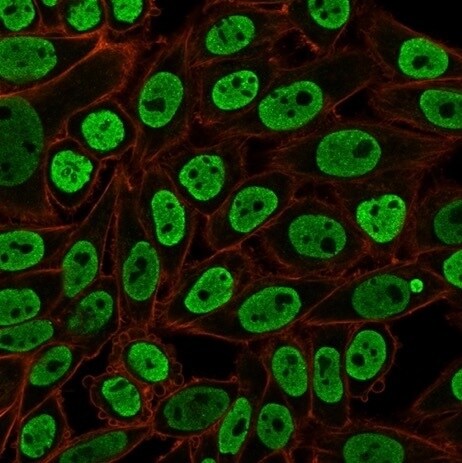 Nuclear Antigen Antibody (NM106) - IHC-Prediluted Immunocytochemistry/ Immunofluorescence: Nuclear Antigen Antibody (NM106) - IHC-Prediluted [NBP2-48213] -