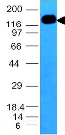 ICAM-3/CD50 Antibody (ICAM3/1019) - IHC-Prediluted Western Blot: ICAM-3/CD50 Antibody (ICAM3/1019) - IHC-Prediluted [NBP2-48227] -