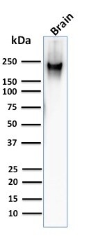 NF-H Antibody (RT97) - IHC-Prediluted Western Blot: NF-H Antibody (RT97) - IHC-Prediluted [NBP2-48235] -