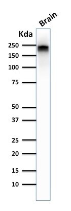 NF-H Antibody (NE14) - IHC-Prediluted Western Blot: NF-H Antibody (NE14) - IHC-Prediluted [NBP2-48252] -