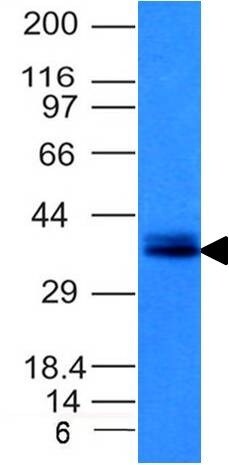 EpCAM/TROP1 Antibody (EGP40/1120) - (ECD) - IHC-Prediluted Western Blot: EpCAM/TROP1 Antibody (EGP40/1120) - (ECD) - IHC-Prediluted [NBP2-48265] -