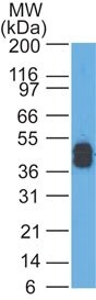 Cytokeratin, LMW Antibody (AE-1) - IHC-Prediluted Western Blot: Cytokeratin, LMW Antibody (AE-1) - IHC-Prediluted [NBP2-48267] -