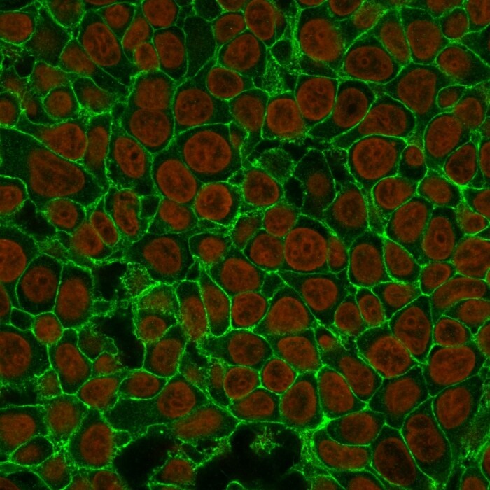 EpCAM/TROP1 Antibody (EGP40/837) - (ECD) - IHC-Prediluted Immunocytochemistry/ Immunofluorescence: EpCAM/TROP1 Antibody (EGP40/837) - (ECD) - IHC-Prediluted [NBP2-48289] -