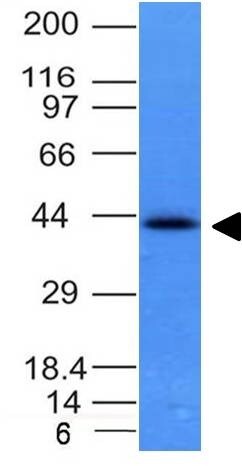 EpCAM/TROP1 Antibody (EGP40/837) - (ECD) - IHC-Prediluted Western Blot: EpCAM/TROP1 Antibody (EGP40/837) - (ECD) - IHC-Prediluted [NBP2-48289] -