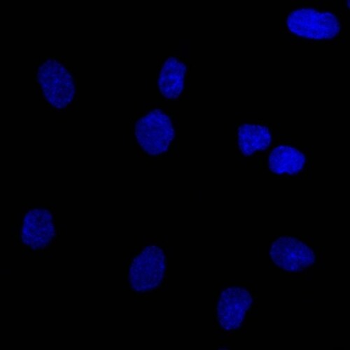 EpCAM/TROP1 Antibody (EGP40/837) - (ECD) - IHC-Prediluted Immunocytochemistry/ Immunofluorescence: EpCAM/TROP1 Antibody (EGP40/837) - (ECD) - IHC-Prediluted [NBP2-48289] -