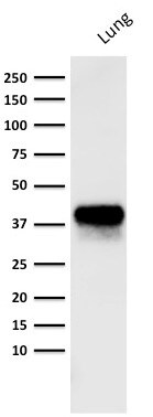 EpCAM/TROP1 Antibody (PAN-EpCAM (Cocktail)) - IHC-Prediluted Western Blot: EpCAM/TROP1 Antibody (PAN-EpCAM (Cocktail)) - IHC-Prediluted [NBP2-48290] -