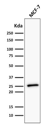 Bcl-2 Antibody (BCL2/782 + BCL2/796) - IHC-Prediluted Western Blot: Bcl-2 Antibody (BCL2/782 + BCL2/796) - IHC-Prediluted [NBP2-48303] -