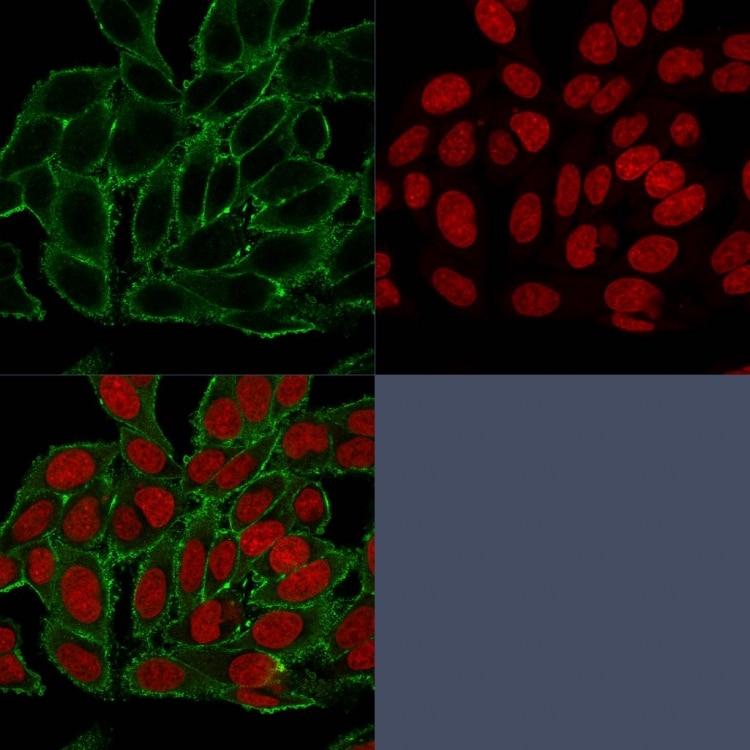 Moesin Antibody (MSN/493) - IHC-Prediluted Immunocytochemistry/ Immunofluorescence: Moesin Antibody (MSN/493) - IHC-Prediluted [NBP2-48306] -