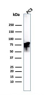 Moesin Antibody (MSN/493) - IHC-Prediluted Western Blot: Moesin Antibody (MSN/493) - IHC-Prediluted [NBP2-48306] -