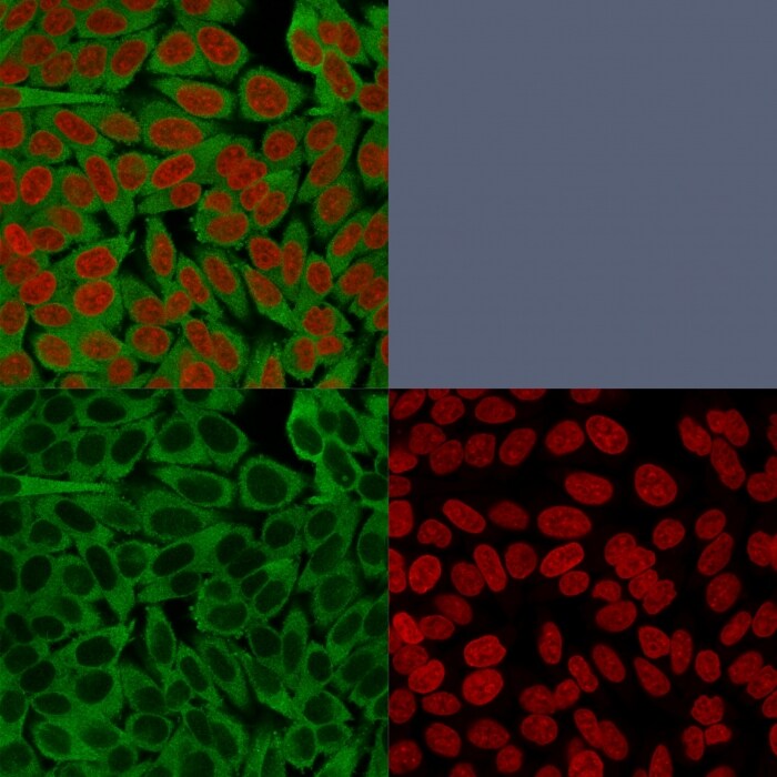 Fascin Antibody (FSCN1/416) - IHC-Prediluted Immunocytochemistry/ Immunofluorescence: Fascin Antibody (FSCN1/416) - IHC-Prediluted [NBP2-48310] -