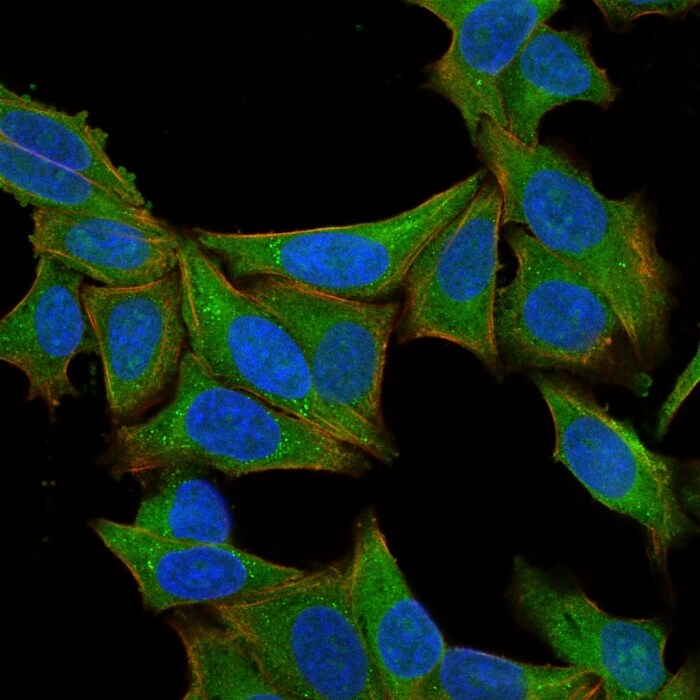 Fascin Antibody (SPM133) - IHC-Prediluted Immunocytochemistry/ Immunofluorescence: Fascin Antibody (SPM133) - IHC-Prediluted [NBP2-48312] -