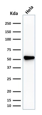 Fascin Antibody (SPM133) - IHC-Prediluted Western Blot: Fascin Antibody (SPM133) - IHC-Prediluted [NBP2-48312] -